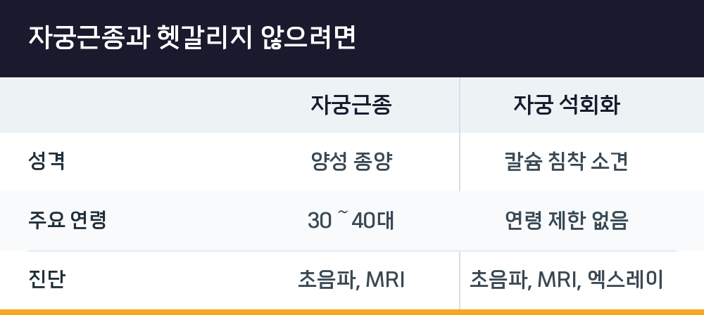 자궁근종과 헷갈리지 않으려면