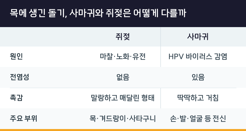 목에 생긴 돌기, 사마귀와 쥐젖은 어떻게 다를까